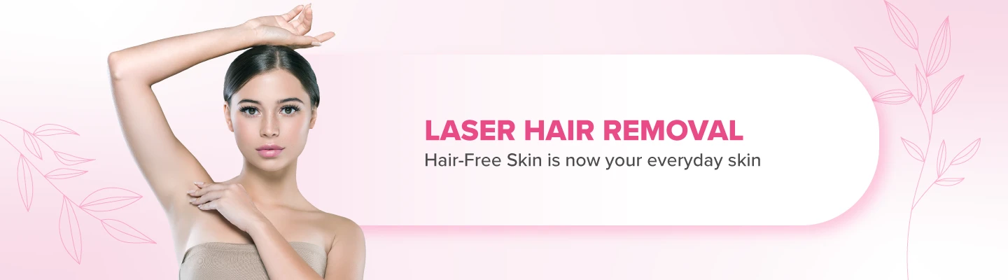 laser hair removal treatment