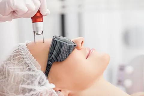 open pores treatment